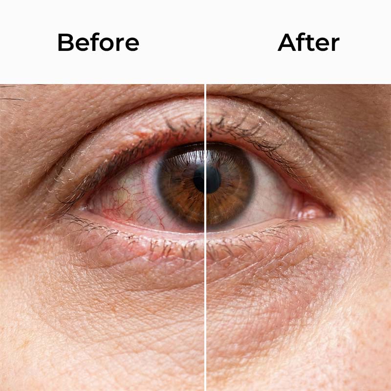 EyeBliss - Mist Relief