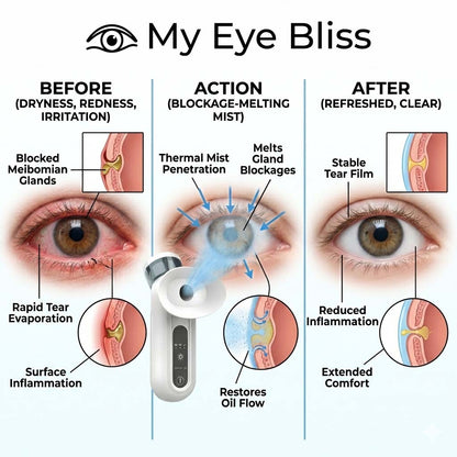 EyeBliss - Mist Relief