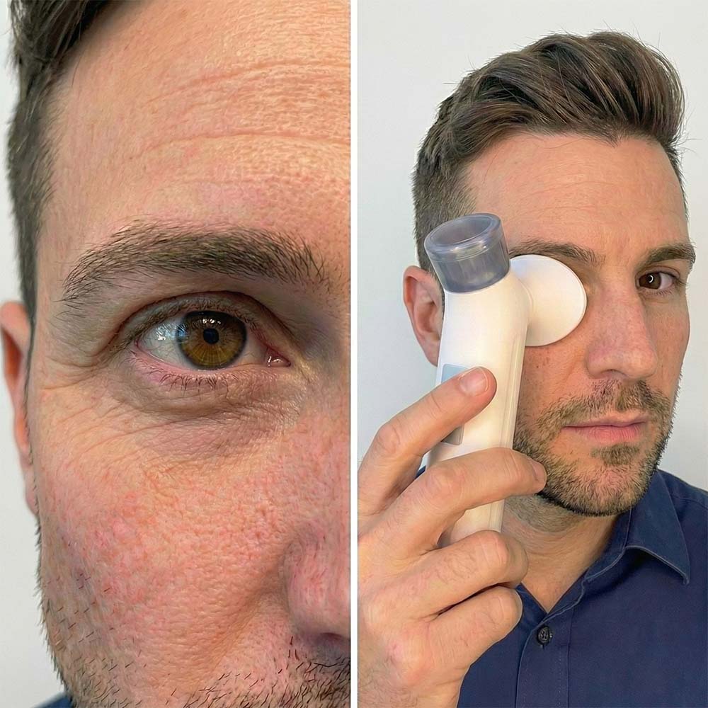 EyeBliss - Mist Relief